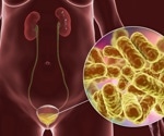 What is Chronic Cystitis?