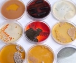 What are Microbial Assays?