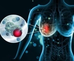 The Importance of Hormone Status in Breast Cancer: A Guide to Hormone Dependent Breast Cancer (HDBC)