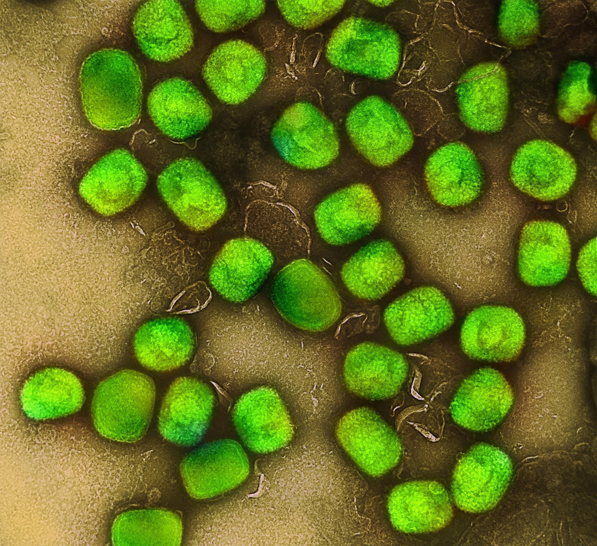 Colorized transmission electron micrograph of monkeypox virus particles (green) cultivated and purified from cell culture. Image captured at the NIAID Integrated Research Facility (IRF) in Fort Detrick, Maryland. Credit: NIAID