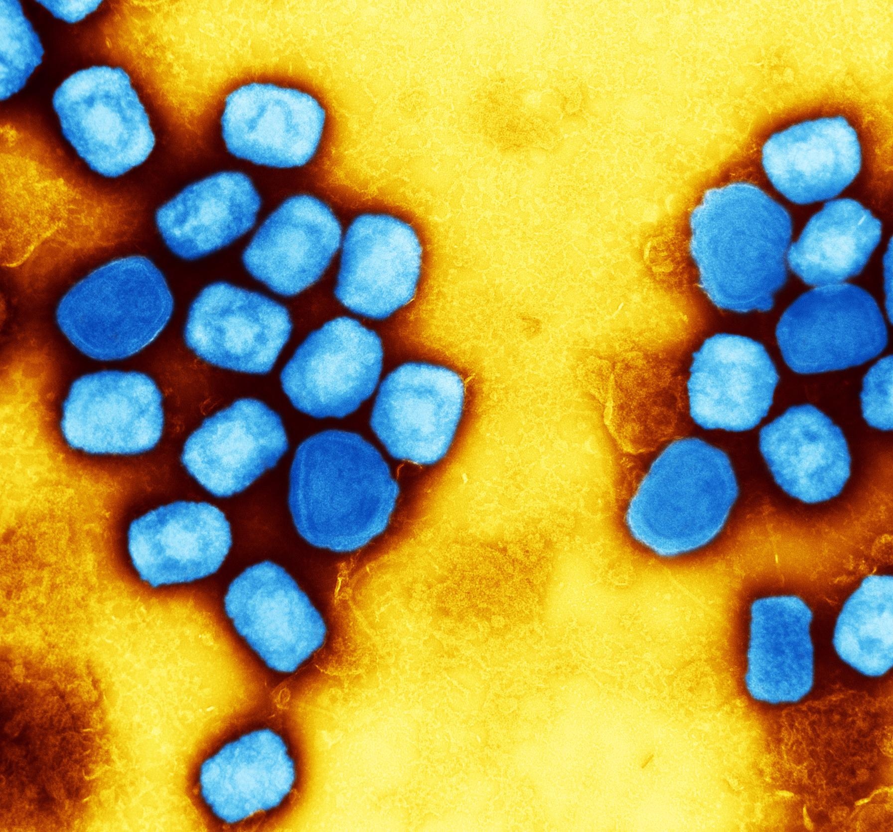 Colorized transmission electron micrograph of monkeypox virus particles (blue) cultivated and purified from cell culture. Image captured at the NIAID Integrated Research Facility (IRF) in Fort Detrick, Maryland. Credit: NIAID