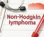 Non-Hodgkin Lymphoma History