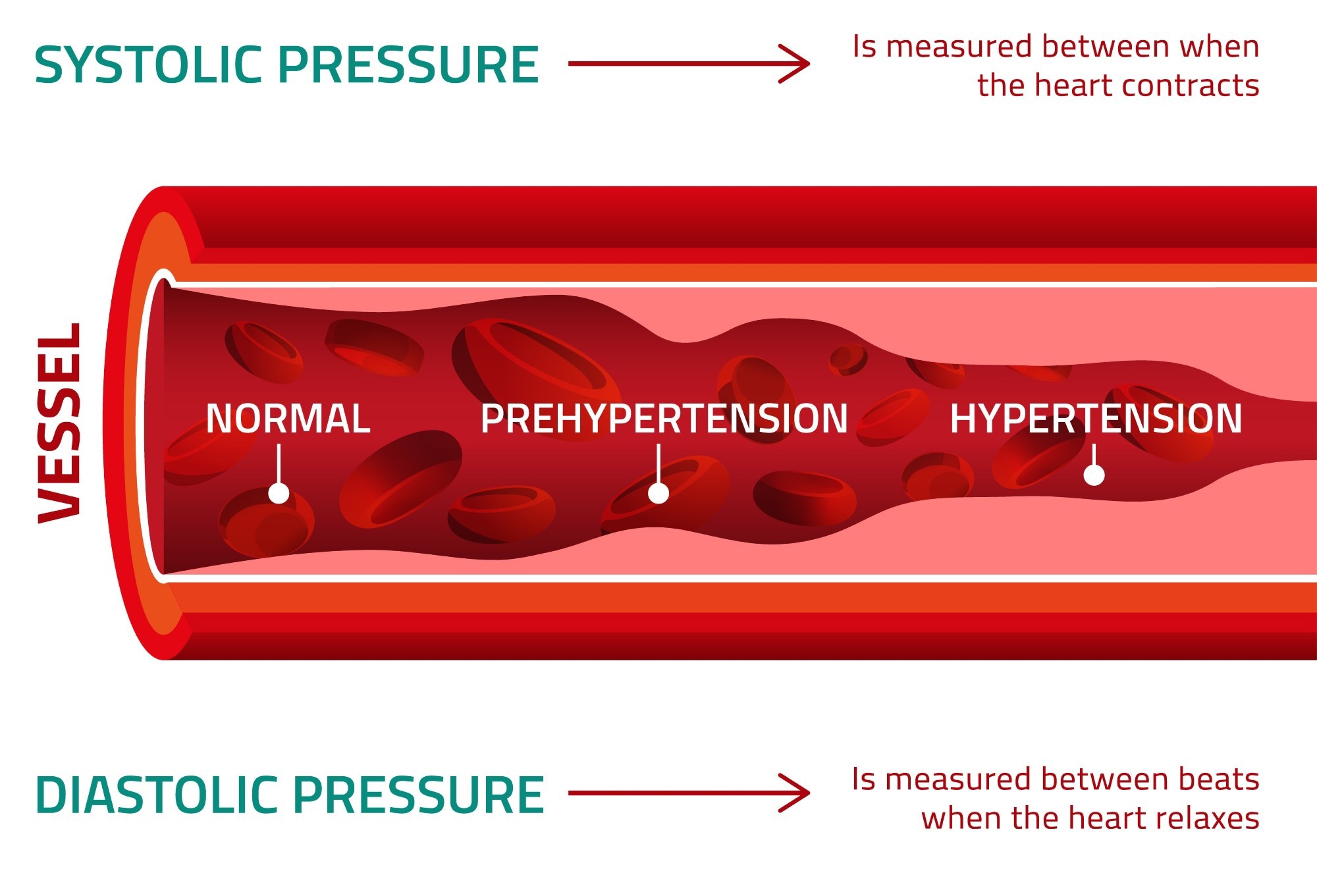 Blood pressure is measured using two numbers: The first number, called systolic blood pressure, measures the pressure in your arteries when your heart beats. The second number, called diastolic blood pressure, measures the pressure in your arteries when your heart rests between beats. If the measurement reads 120 systolic and 80 diastolic, you would say, “120 over 80,” or write, “120/80 mmHg.”. Image Credit: Double Brain / Shutterstock