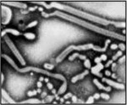 Avian Influenza Virus A (H5N1)