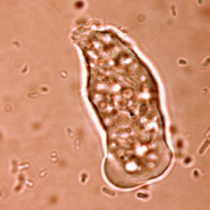 Each year, there are an estimated 50 million cases of amoebic dysentery, causing up to 100,000 deaths, mostly in developing countries. On Thursday 24 February 2005, researchers at the Wellcome Trust Sanger Institute and their colleagues reported in Nature magazine the genome sequence of the parasite that causes the disease, Entamoeba histolytica.