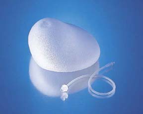 Although apparently uncommon, fungal contamination of saline-filled breast implants is readily preventable, according to a study in the July 1 issue of The Journal of Infectious Diseases, now available online.