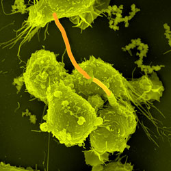 Scanning electron micrograph of macrophages infected with Bacillus anthracis - Image: Max Planck Institute for Infection Biology