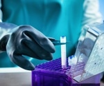 Biobanking and the future of sample handling