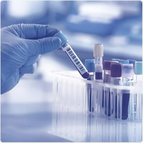 Cerba Research offers state-of-the-art in-vitro diagnostics