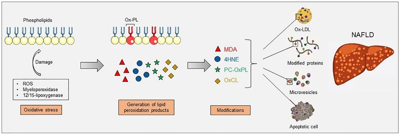 A Gene based strategy to prevent the progression of Non-Alcoholic Fatty Liver Disease (NAFLD)