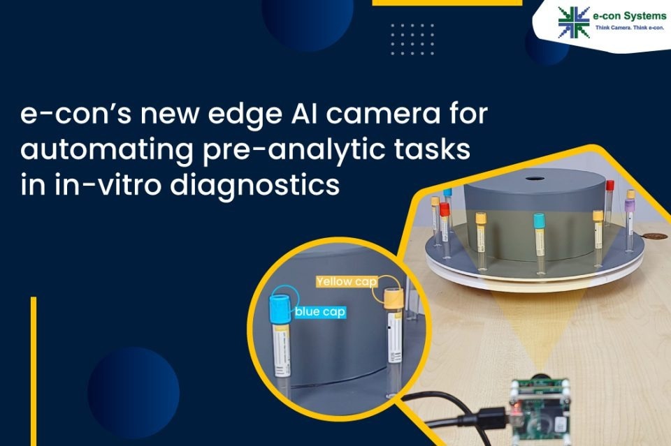 AI cameras to automate pre-analytic tasks in in-vitro diagnostics