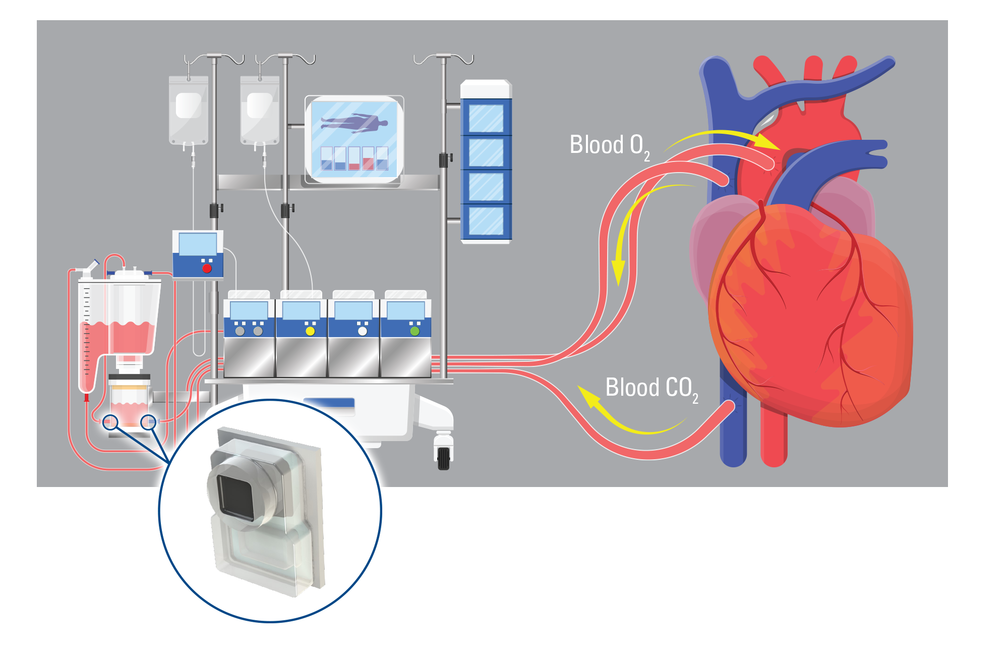 Benefits of Ambulatory Blood Pressure Monitoring