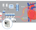 The utility of blood pressure monitoring in medical applications