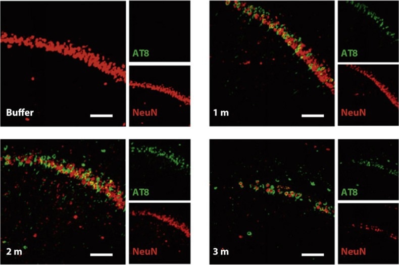 Pre-formed fibrils (PFFs) and the modelling of neurodegenerative diseases