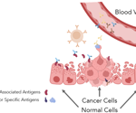 Autoantibodies: powerful biomarkers in cancer precision medicine