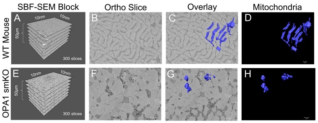 Using Amira Software to measure 3D organelle morphology
