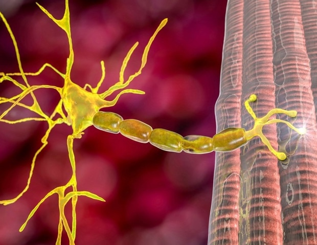 Leading the way in Myasthenia Gravis (MG) detection