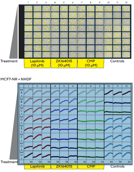 Incucyte® S3 vessel views enable rapid visualization and quantification of treatment effects. MCF7 cells co-cultured with NHDFs were seeded in pre-coated (Matrigel) flat bottom 96-well plates (1:1 ratio, 1,000 cells/well of each) and multi-spheroids allowed to form (3 d). Spheroids were then treated with serial dilutions of known standard of care and cytotoxic compounds (5 d). Incucyte® microplate vessel views show effects of treatments on multi-spheroid size. Top image shows Brightfield Object Area (μm2) segmentation mask (yellow) 5 d post treatment. Bottom image shows the individual well Total Brightfield Object Area (μm2) (y-axis) over time (0–5 d post treatment) (x-axis).