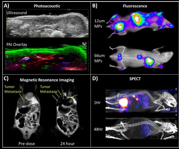 Biological imaging applications of FNP nanoparticles. (A) Multiplex imaging using photoacoustic tomography of a mouse model shows nanoparticle accumulation in the skin (green). Oxygenated and deoxygenated blood can also be visualized (red and blue, respectively). (B) Fluorescence of dye-encapsulated nanoparticles. Biodegradable microparticles containing these nanoparticles were injected into mice. Smaller particles accumulated in the liver while larger particles tracked to the lungs. (C) MRI imaging of liver metastases in a mouse tumor model using iron oxide-based nanocrystals (IONC) encapsulated nanoparticles. Yellow lines point to the locations of liver metastases before and after injection of IONC nanoparticles. Nanoparticles persist in healthy tissues (appearing black) — generating contrast that allows better visualization of metastasis. (D) SPECT imaging of 111In labeled nanoparticles shows biodistribution and clearance profile over time.