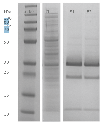 SDS-PAGE of proteins purified with PhyTip® resin columns