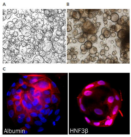 Undifferentiated and Differentiated Human Liver Organoids
