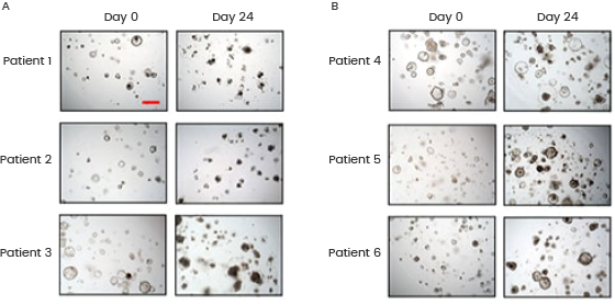 Representative bright-field images for colorectal cancer organoids on day 0 and day 24 in response to 5-Fu treatment. (A) 5-Fu sensitive organoids; (B) 5-Fu resistant organoids. Sino Biological proteins used in the organoid culture: RSPO1 (Cat#: 11083-HNAS), NOG (Cat#: 50688-M02H), EGF (Cat#: 50482-MNCH).