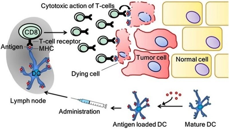 The induction of a tumor-specific immune response by dendritic cell vaccination.