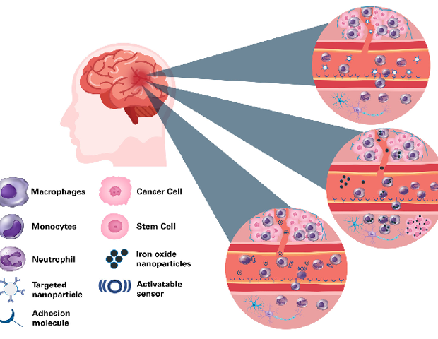 Preclinical MRI for neurological diseases with cellular and molecular imaging