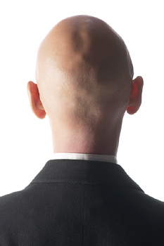 Despite an enormous range of treatments, obscure lotions and tinctures there appears to be very few successful counter-measures for hair loss in men. Beginning with receding hairlines, every second man suffers from hair loss to some degree, and it has always been suspected that hereditary factors are important in causing hair loss.