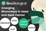 Targeting biomarkers in head and neck cancer: FGFR1, KLK6, Osteonectin
