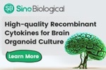 Innovative applications of brain organoids in neurological studies