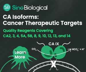 Carbonic anhydrases: Isoforms as therapeutic targets for cancer
