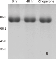 Recombinant protein expression