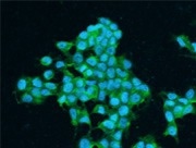Immunofluorescence staining of human IGF1R in MCF7 cells.