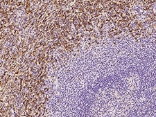 Immunochemical staining CD16a in human spleen with rabbit polyclonal antibody.