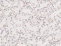 Immunochemical staining HMGB1 in human kidney.