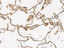 Immunochemical staining of human RAGE in human lung.