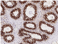 Immunochemical staining of human FASN in the human breast.