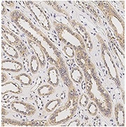 Immunochemical staining of human AGER in human kidney.