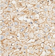 Immunochemical staining of human APOE in human liver.