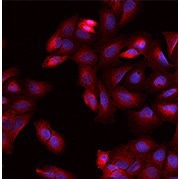 Immunofluorescence staining of DPYSL2 in U2OS cells.