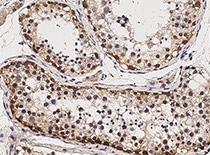 Immunochemical staining of human SOX2 in human testis. Applications: IHC-P,