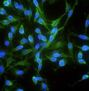 Immunofluorescence staining of human CDH2 in Hela cells.