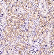 Hela whole cell lysate probed with anti-CDH13 rabbit polyclonal antibody.