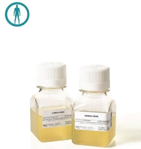 Normal donor human urine for biomarker research