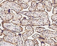 Immunochemical staining of human ACVR2B in human placenta.