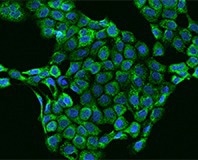 Immunofluorescence staining of Inhibin beta B in A431 cells.
