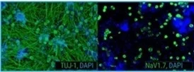 axoCells™ : Functional human iPSC-derived Sensory Neurons for drug discovery and research