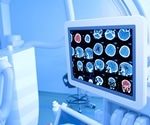 FDA approves first cranial dural sealant