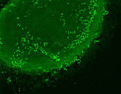 Very few n-cofilin deficient cells are found outside the tissue, which indicates a reduction in migration.